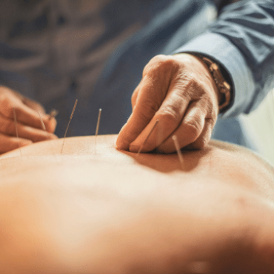 Dry Needling / Intramuscular Stimulation (IMS)​ - Trifecta Rehab